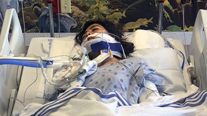 Teen Hit by Vehicle in Medically Induced Coma 2